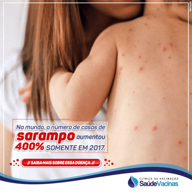 No mundo, o número de casos de sarampo aumentou 400% somente em 2017